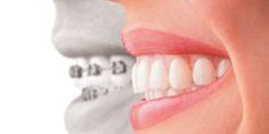 Principe de l'orthodontie